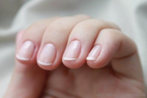 Почему ногти болеют и плохо растут. Почему ногти болеют и плохо растут.