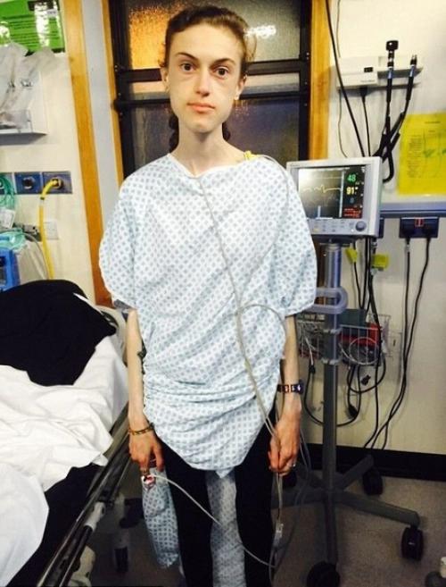 Эта девушка смогла победить анорексию, которой страдала с 15 лет. 01