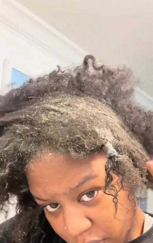 Пыль, сыпь и моль: американка год не мыла голову, последствия шокируют.

