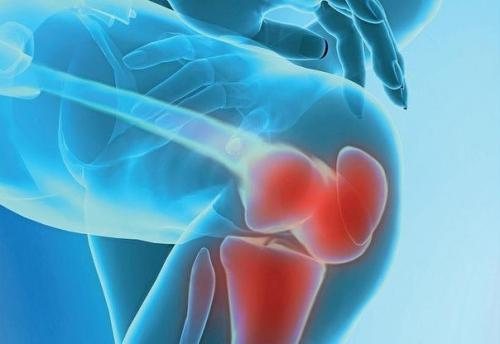 Отличный рецепт от боли в суставах.