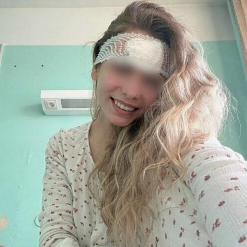 Из-за обычного прыщика россиянке разрезали лоб и положили в больницу. 
