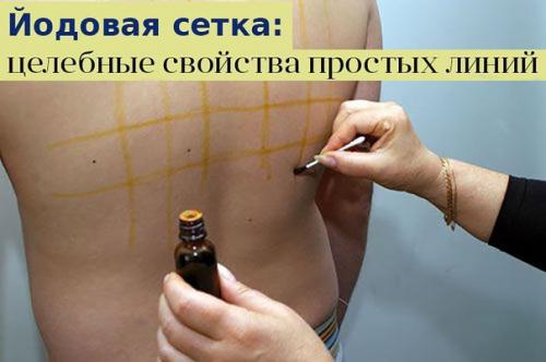 Йодовая сетка: целебные свойства простых линий.

