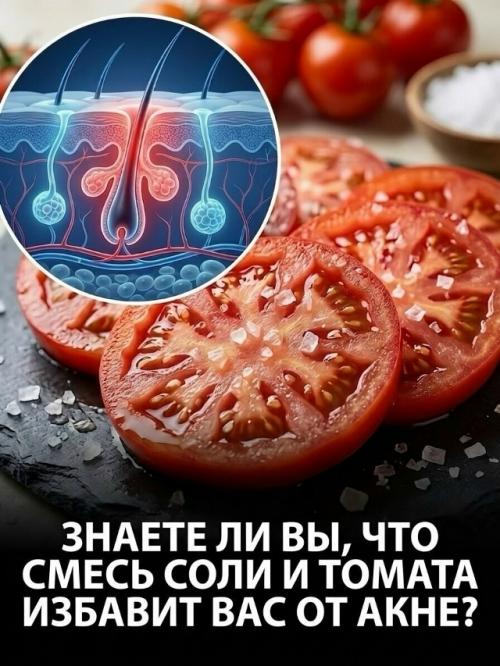 Арбуз с щепоткой соли способствует поддержанию водного баланса, что помогает уменьшить временное вздутие живота. 04