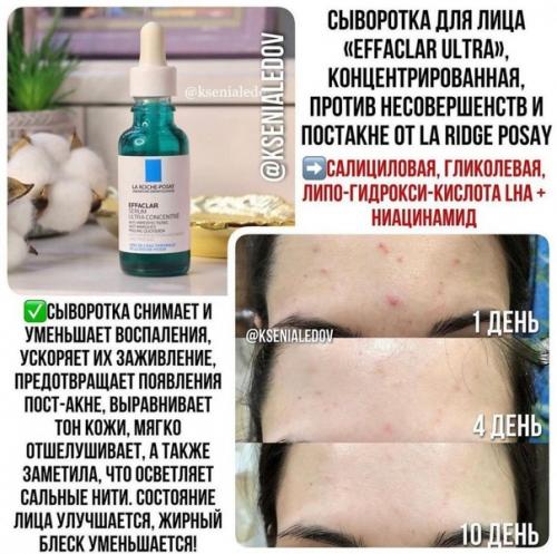 Что поможет избавиться от акне! 02