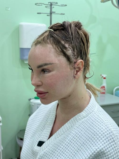 Красота в глазах хирурга: сеть в шоке от результата пластической операции, хотя врач и пациентка в восторге. 01