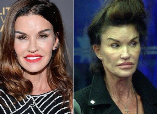 Американская супермодель дженис дикинсон до и после пластики! 01