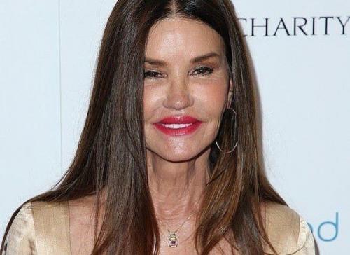 Американская супермодель дженис дикинсон до и после пластики! 04