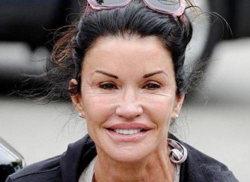 Американская супермодель дженис дикинсон до и после пластики! 03