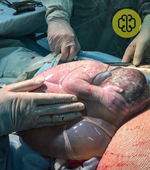 Иногда ребёнок может появиться на свет, пока плодный пузырь ещё не разорвался. 01 Иногда ребёнок может появиться на свет, пока плодный пузырь ещё не разорвался. 01