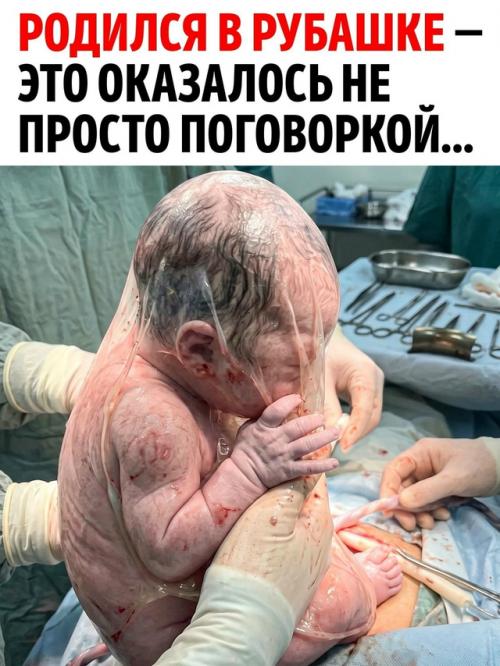 Иногда ребёнок может появиться на свет, пока плодный пузырь ещё не разорвался.  