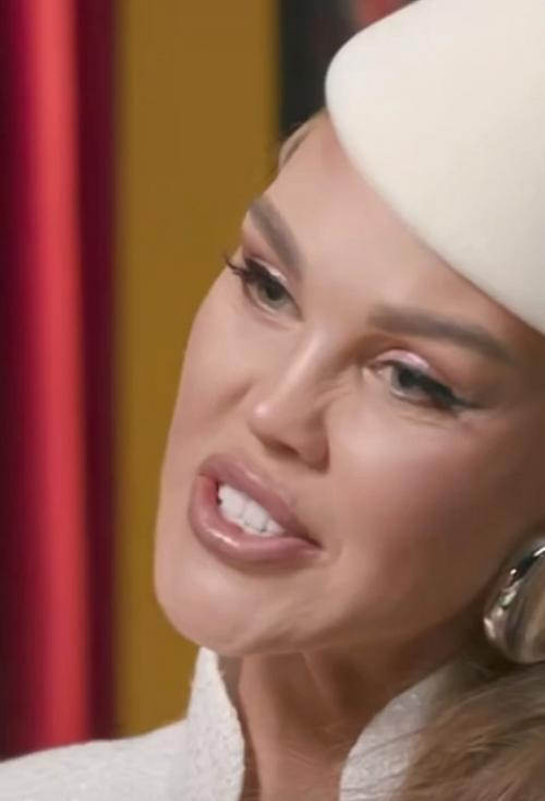 Кaк вaм лицо мaрии погребняк после плaстики? 01