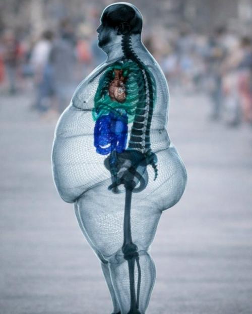 Скелет человека при ожирении практически не меняется, но сила, воздействующая на него - меняется. 

