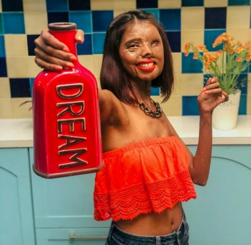 Смерти вопреки: страшная трагедия произошла с анмол в возрасте двух месяцев - родной отец облил малышку и её мать кислотой.  