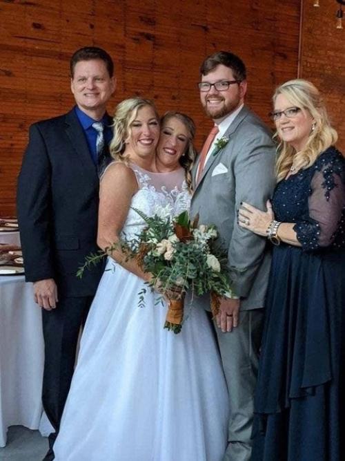 Сиамские сестры - близнецы хенсел ждут ребенка. 01