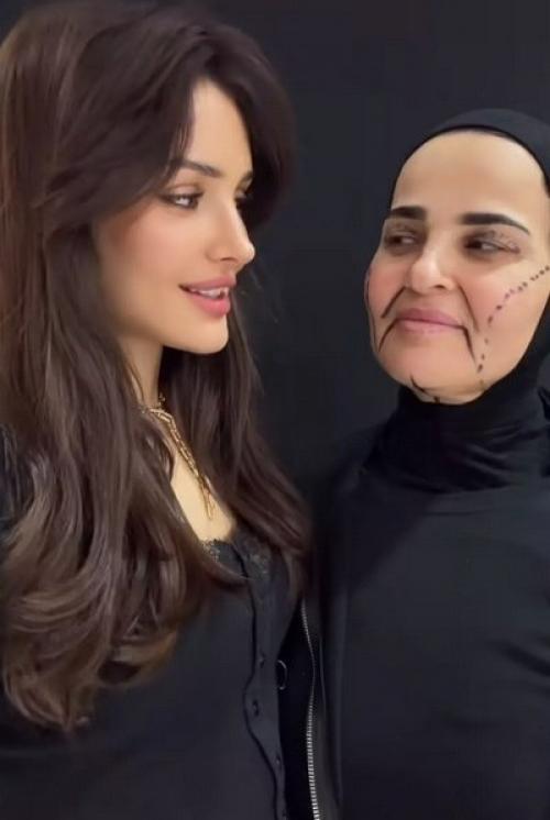 Она весила больше 100 кг. 01