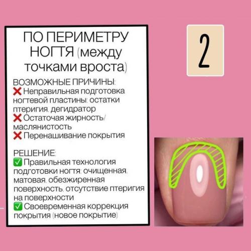 5 самых распространенных типов отслоек, которые встречаются у девчонок! 02 5 самых распространенных типов отслоек, которые встречаются у девчонок! 02