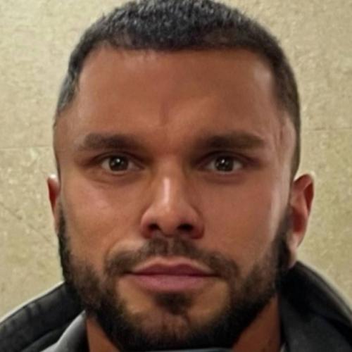 Антон Гусев с новым Открытым Взглядом после плaстики. 01