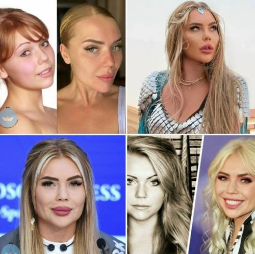 Признание Карины кросс о сожалении по поводу удаления комков биша - это редкий и ценный пример честности в мире шоу-бизнеса.

