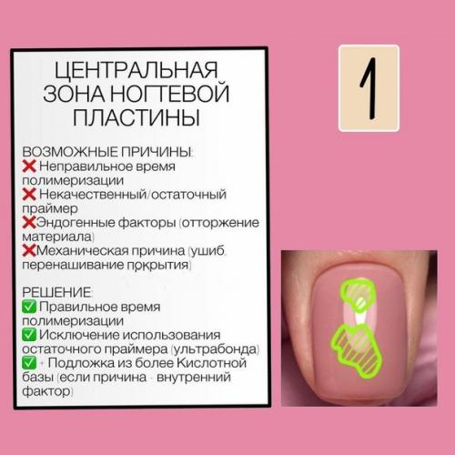 5 самых распространенных типов отслоек, которые встречаются у девчонок! 01 5 самых распространенных типов отслоек, которые встречаются у девчонок! 01