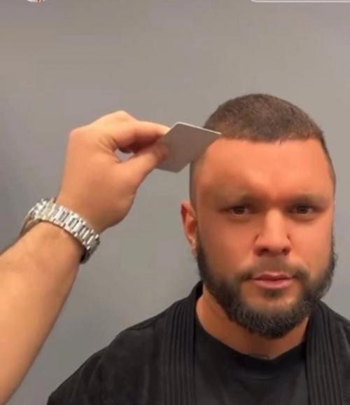 Антон Гусев с новым Открытым Взглядом после плaстики. 02