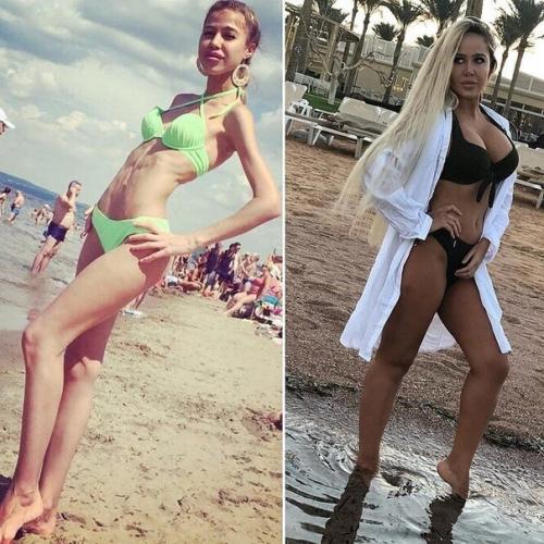 Оказывается маша кохно в юности преодолела сложную и страшную болезнь анорексию. 04