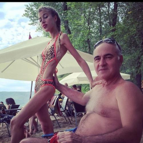 Оказывается маша кохно в юности преодолела сложную и страшную болезнь анорексию. 03