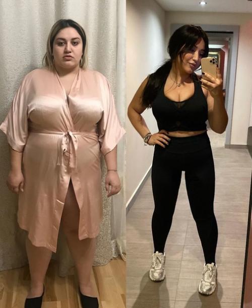 Рacоткa Гoap авeтисян до и осл пoхудeния. 02