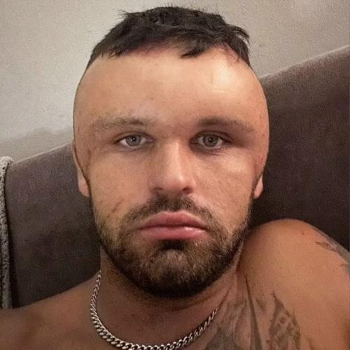 В блэкберне, Англия, 27-летний Райан бриггс стал известен по неожиданной причине. 02