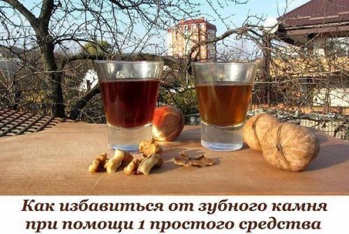Как избавиться от зубного камня при помощи 1 простого средства. Как избавиться от зубного камня при помощи 1 простого средства.