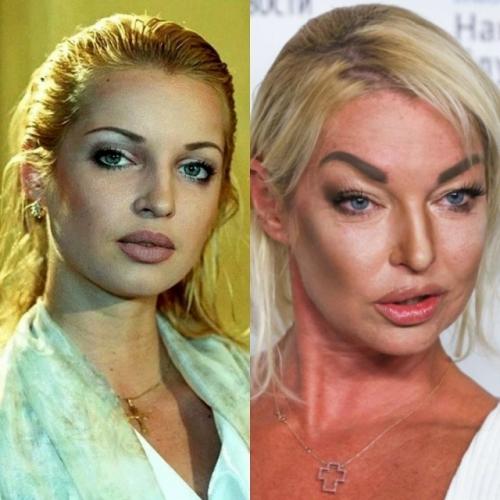 Вы их такими не помните - 7 фотографий знаменитостей времен начала их карьеры. 02