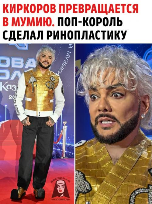 Филипп Киркоров вновь взорвал шоу-бизнес, решившись на очередную экстремальную операцию.  