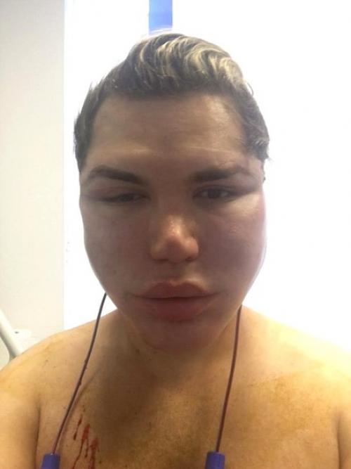 Родриго Алвес перенес порядка 70 операции, чтобы стать похожим на игрушечного Кена. 03