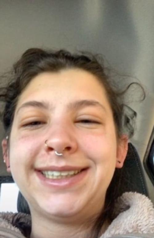 Просто у девочки аллeргия на аллeргию. 05