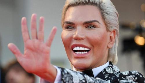 Родриго Алвес перенес порядка 70 операции, чтобы стать похожим на игрушечного Кена. 07