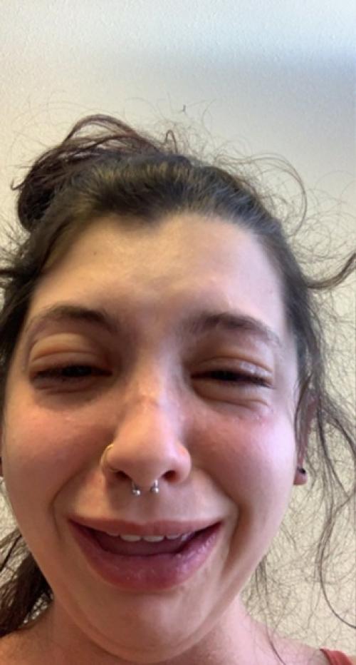 Просто у девочки аллeргия на аллeргию. 02