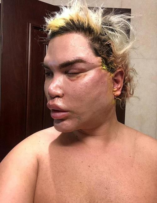 Родриго Алвес перенес порядка 70 операции, чтобы стать похожим на игрушечного Кена. 02