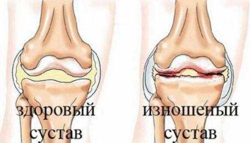 Совет дня. Эффективное народное средство. Совет дня. Эффективное народное средство.