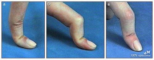 Мы лечим себя. 01 Мы лечим себя. 01