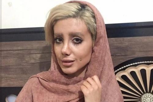 Иранка сделала 50 операций, чтобы стать похожей на Анджелину Джоли. 02