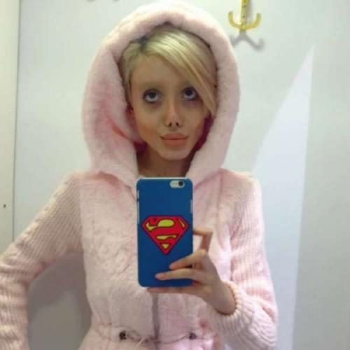 Иранка сделала 50 операций, чтобы стать похожей на Анджелину Джоли. 05