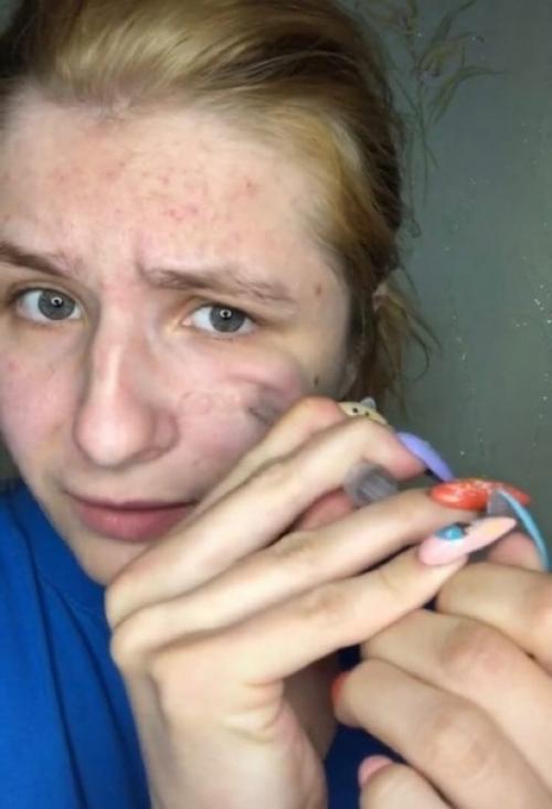 Говорят, что вакуумные очистители пор можно заменить более бюджетной альтернативой - обычным шприцем. 01