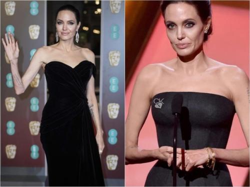 Ого, а вы знали, что Анджелина Джоли болела анорексией? 03