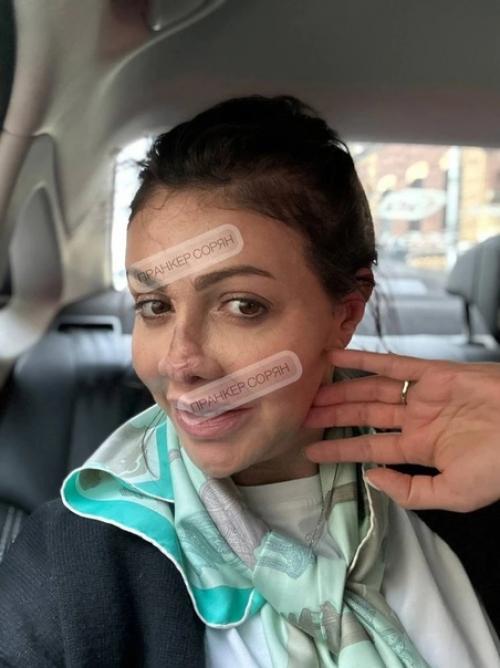 Вернувшей нос экс - супруге Аршавина Алисе Казьминой предстоит новая операция. 01 Вернувшей нос экс - супруге Аршавина Алисе Казьминой предстоит новая операция. 01