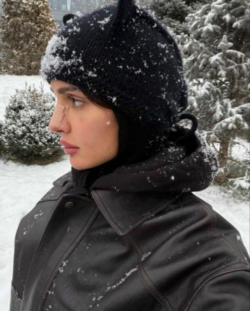 Блогер Дина саева на связь после повторной пластики вышла. 01