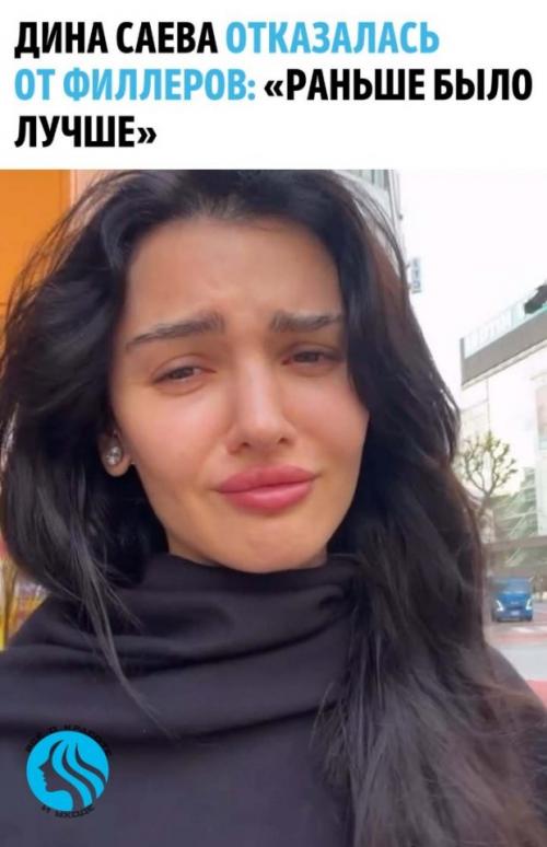 Дина саева рассказала, что приняла решение убрать филлеры из губ. 

