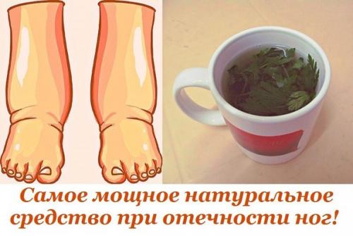 Отеком называют увеличение объема жидкости в межклеточном пространстве.  