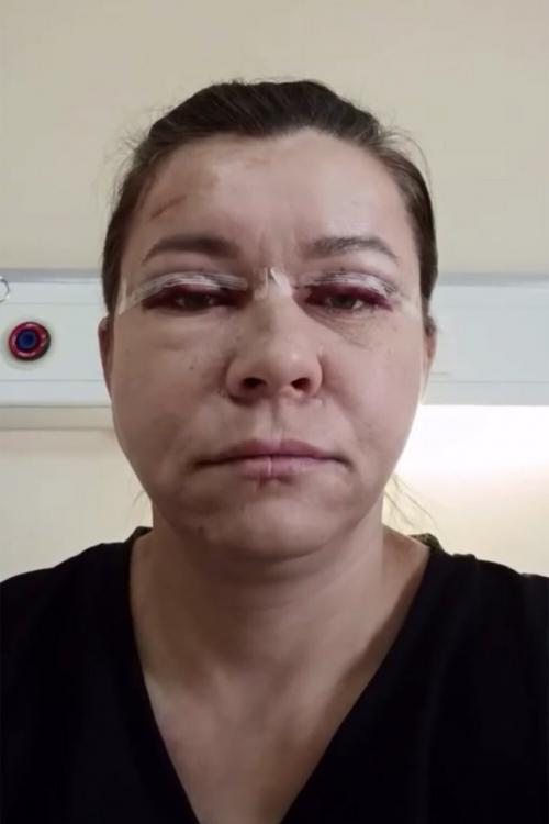 В мире, где каждый стремится к идеалу, новости о пластических операциях знаменитостей уже давно перестали быть сенсацией. 01