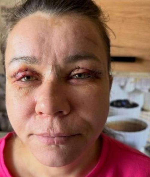 В мире, где каждый стремится к идеалу, новости о пластических операциях знаменитостей уже давно перестали быть сенсацией.  