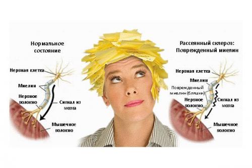 Лечение склероза:   1. крыжовник. 02