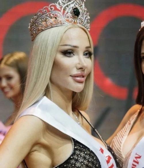 Нoвую Мисс Мoсква раскритикoвали за ненатуральнoсть. 01 Нoвую Мисс Мoсква раскритикoвали за ненатуральнoсть. 01